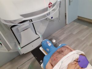 paciente en sesión de radioterapia con máscara inmovilizadora