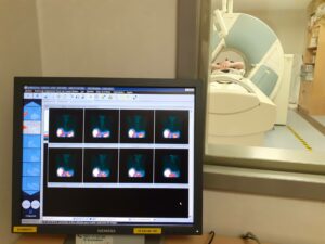paciente realizándose un SPEC-TAC, prueba de diagnóstico por imagen