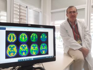 el neuroólogo Felix Viñuela especialista en Alzhéimer